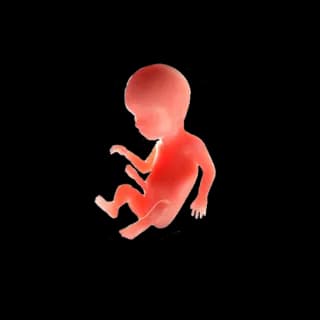 Baby at 18 weeks