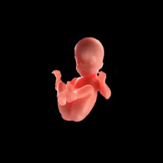 Baby at 26 weeks