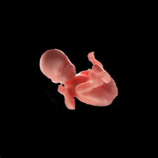 Baby at 28 weeks