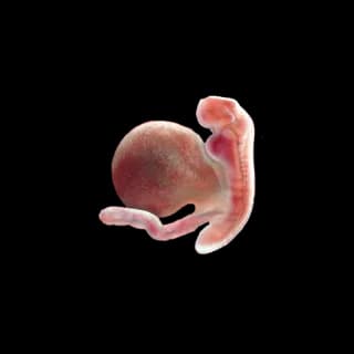 Baby at 5 weeks