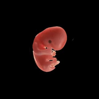Baby at 7 weeks