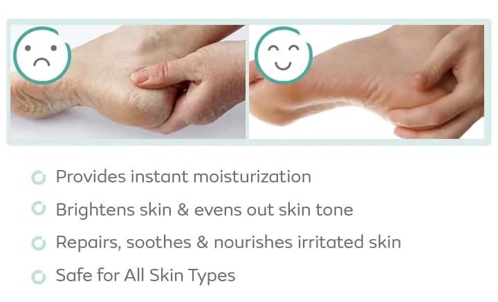 Ubtan Body Lotion with Turmeric, Cocoa Butter & Shea Butter | Soothes Dry Skin | Provides 24 Hours Moisturization | Makes the Skin Glow 275ml  WHAT IS IT?