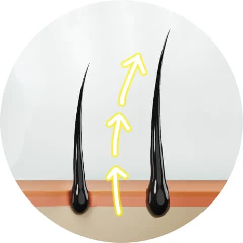Promotes hair growth 