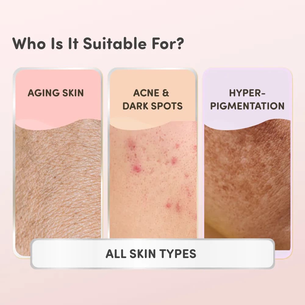 Anti Ageing Cream - Ayurvedic Formulation | Helps Control Signs of Ageing | Brightens Skin | Reduces Dark Spots & Pigmentation | Toxic Free (50 Gms)