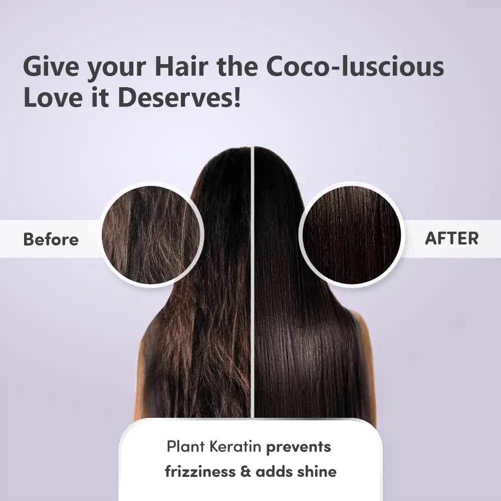 Pre & Post Pregnancy Hairfall Conditioner with Onion - 200 ml