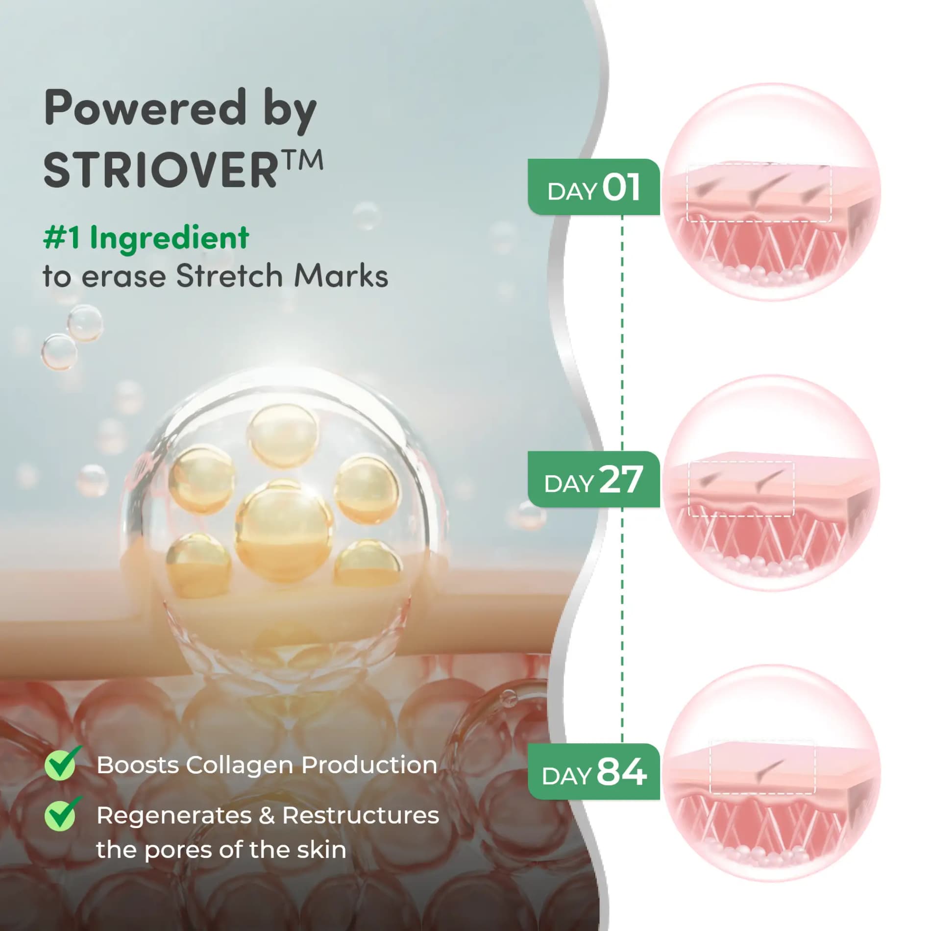Stretch Marks Kit - Removes Scars | Made with Natural Ingredients | Tightens Skin - (Stretch Mark Oil - 100 ml, Stretch Marks Cream - 100ml)