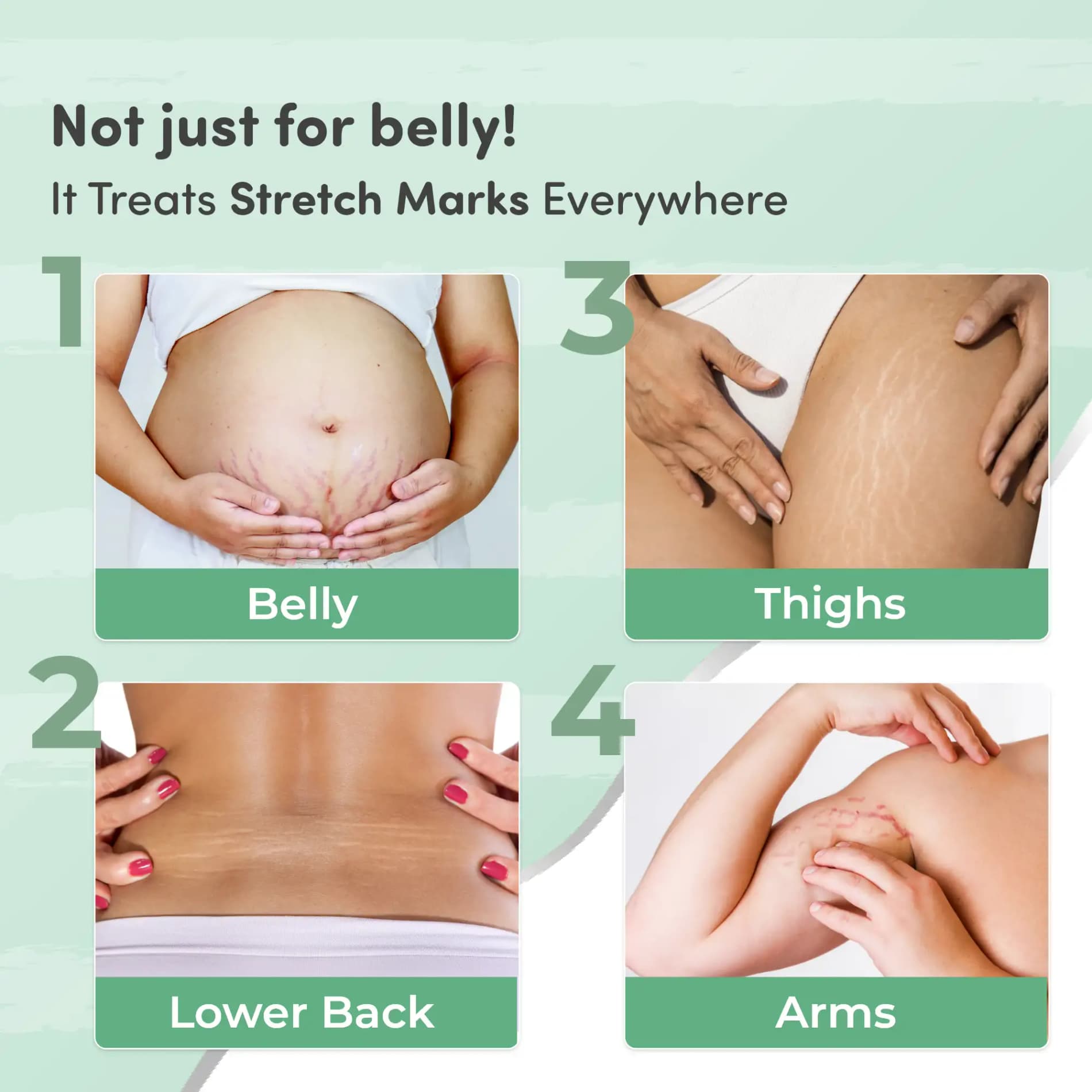Stretch Marks Kit - Removes Scars | Made with Natural Ingredients | Tightens Skin - (Stretch Mark Oil - 100 ml, Stretch Marks Cream - 100ml)