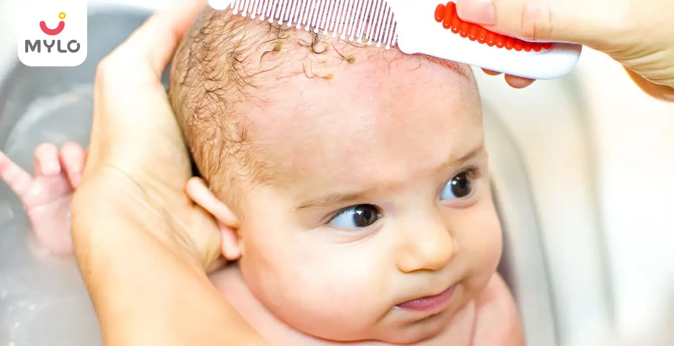  Cradle Cap in Babies: Causes, Treatment & How to Remove It Safely
