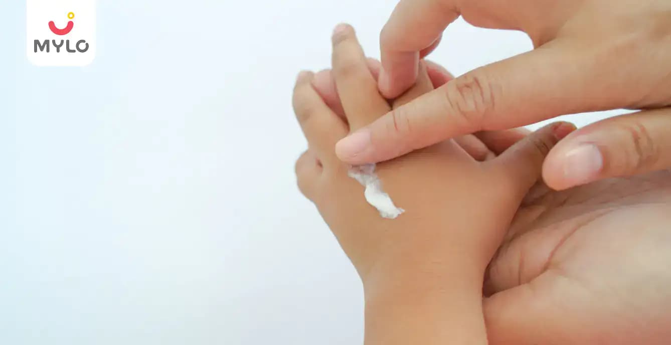 How to treat burns in toddlers