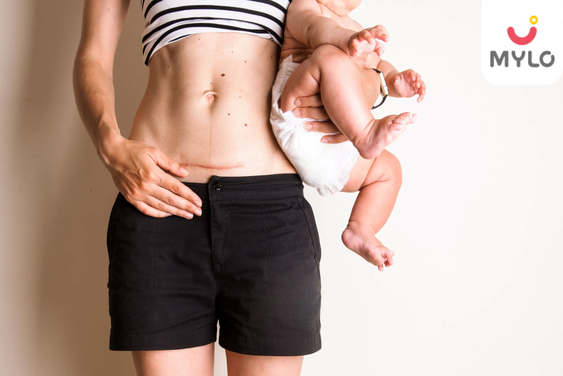 The Ultimate Guide to Having Sex After C Section