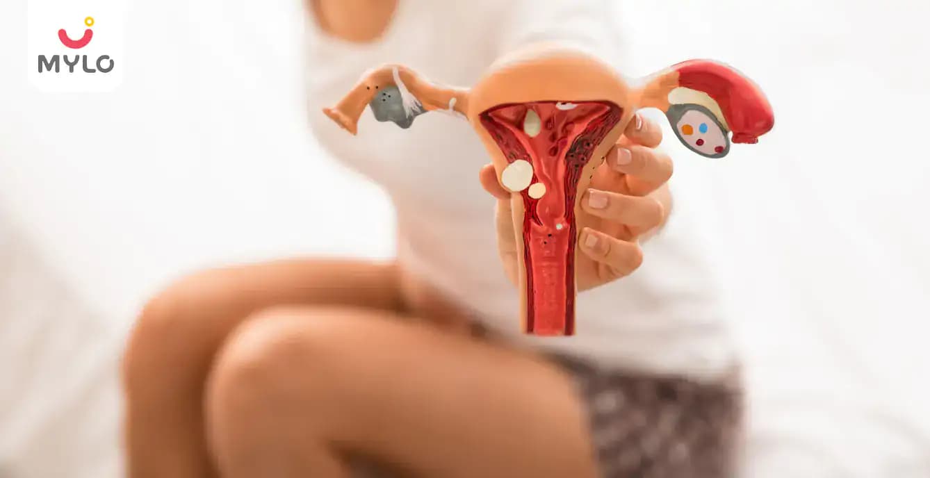 Ovarian Cyst: Types, Causes, Symptoms and Treatment 