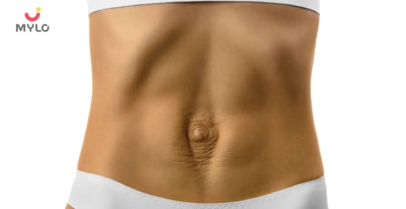 Diastasis Recti: Causes, Symptoms, Risks & Preventions