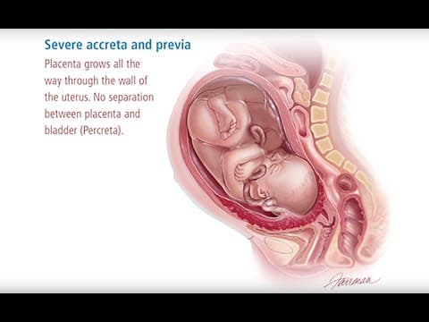 What is Placenta