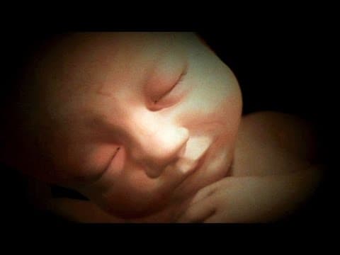 Dreaming In The Womb - 33 Week Fetus