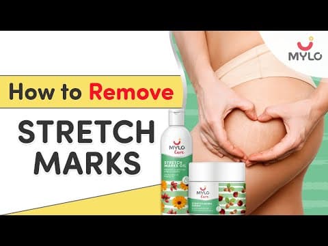 Easy Tips To Prevent Stretch Marks Naturally During Pregnancy