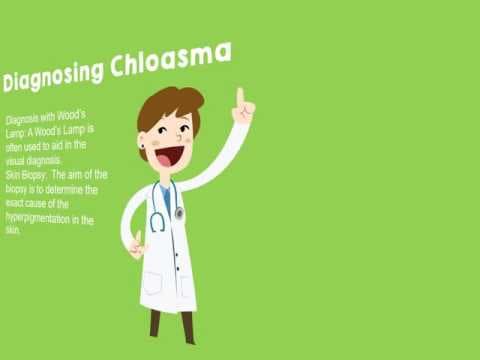 Chloasma: The pregnancy mask and what to do about it