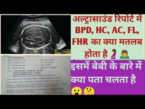 please subscribe "Mom & Baby Care" on YouTube for more videos