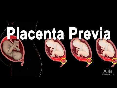 What is Low Lying Placenta & its causes?
