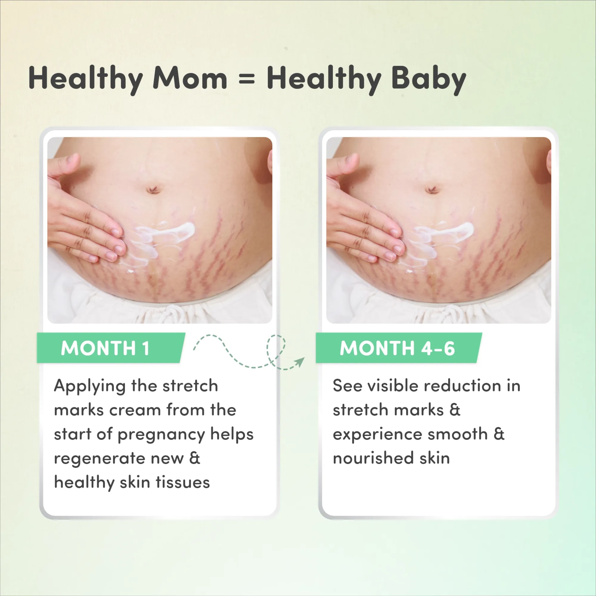 Pregnancy Wellness Super Saver Combo - Stretch Marks Cream for Women 100g + Long Grain Pure Saffron for Pregnant Women (Kesar) - 2g