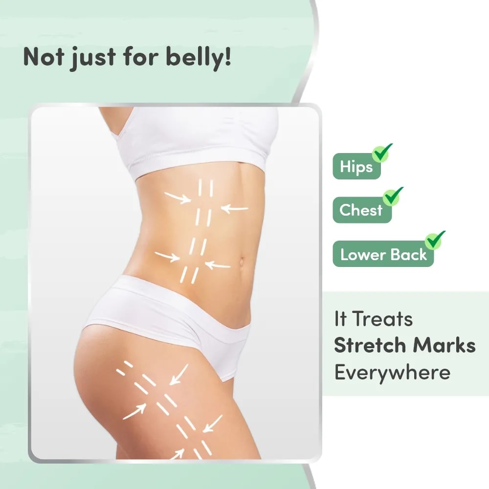 Stretch Marks Oil With Sea Buckthorn, Rosehip, Argan & Coconut Oil | Scars & Stretch Mark Lightening | Natural Skin Care Solution for Pregnant Women - 100ml