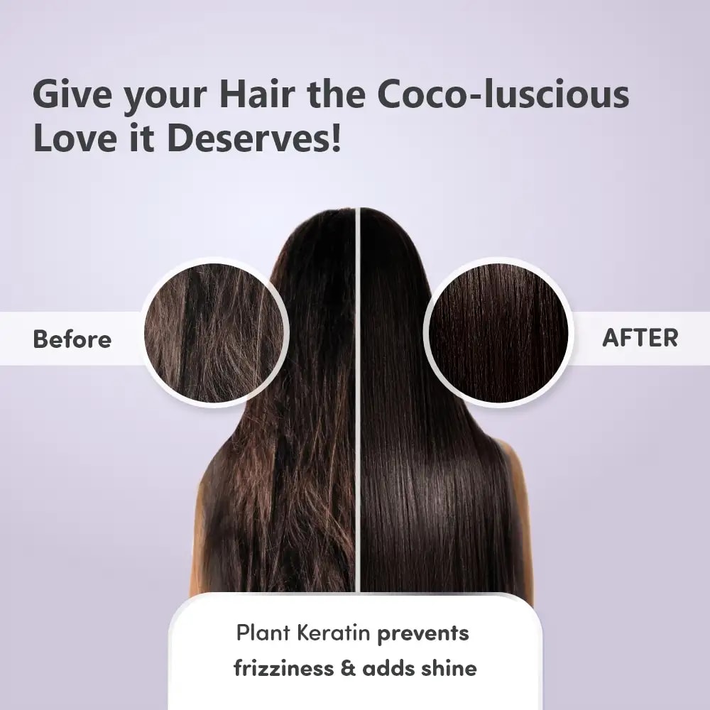 Pre & Post Pregnancy Hairfall Conditioner with Onion - 200 ml