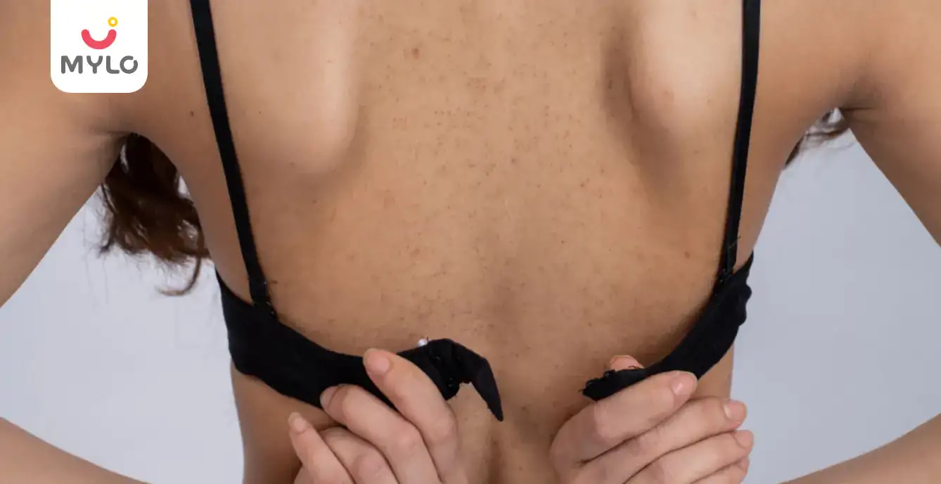 Can A Maternity Bra Prevent Your Breasts From Getting Itchy During Pregnancy And While Breastfeeding? 