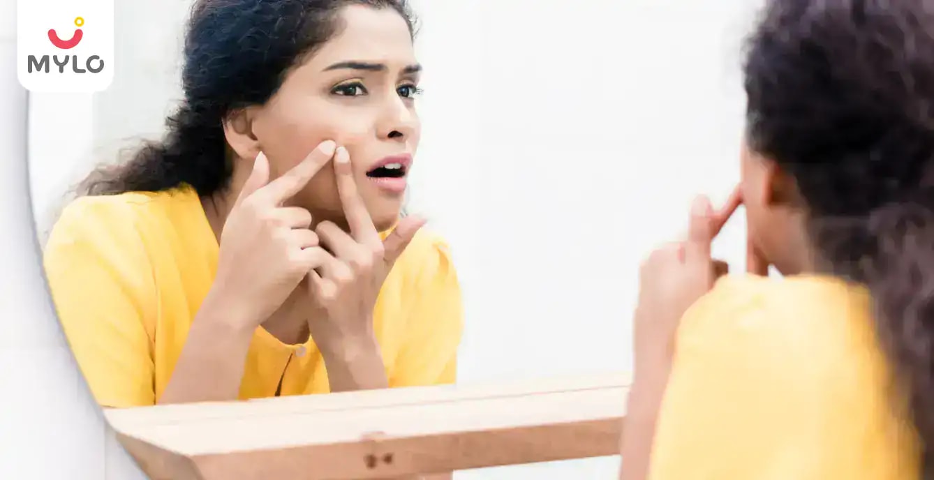 చర్మంపై మొటిమలు రావడానికి 3 ప్రధానమైన కారణాలు