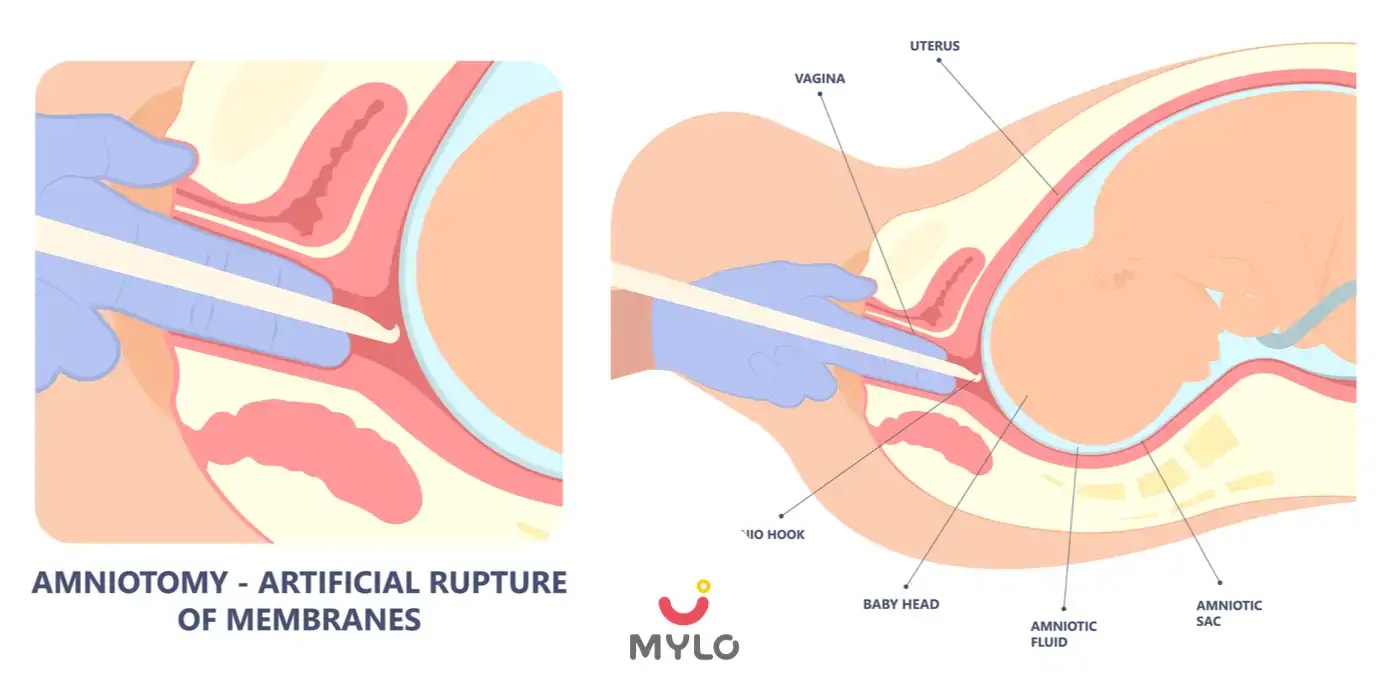 What are the Symptoms and Causes of a Premature Delivery & How to Prevent it?