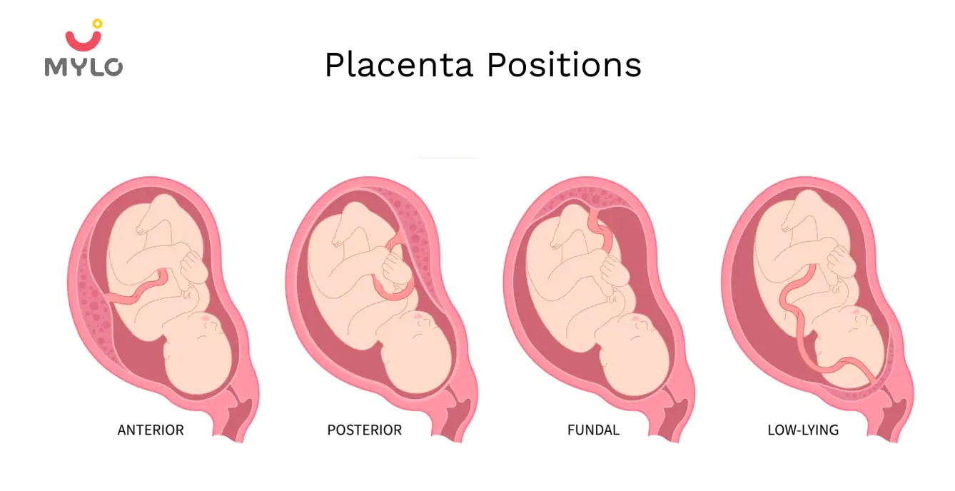 Placenta Position: How It Affects Your Pregnancy and Delivery
