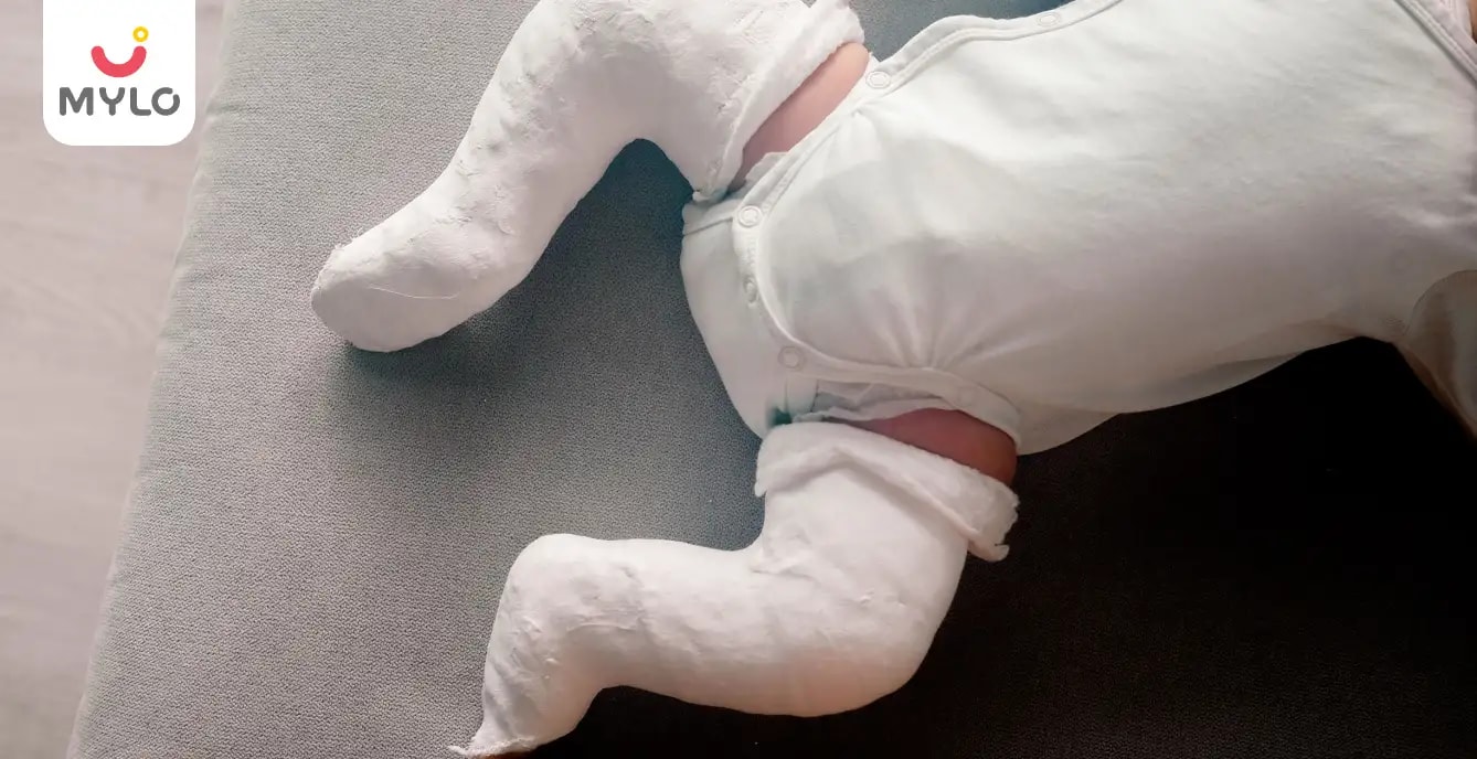 Clubfoot (Talipes Equinovarus): Meaning, Symptoms & More