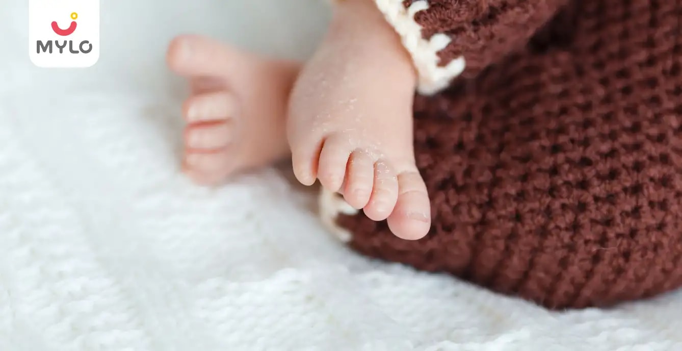 Newborn Skin Peeling: Causes, Is It Normal & How to Care for It