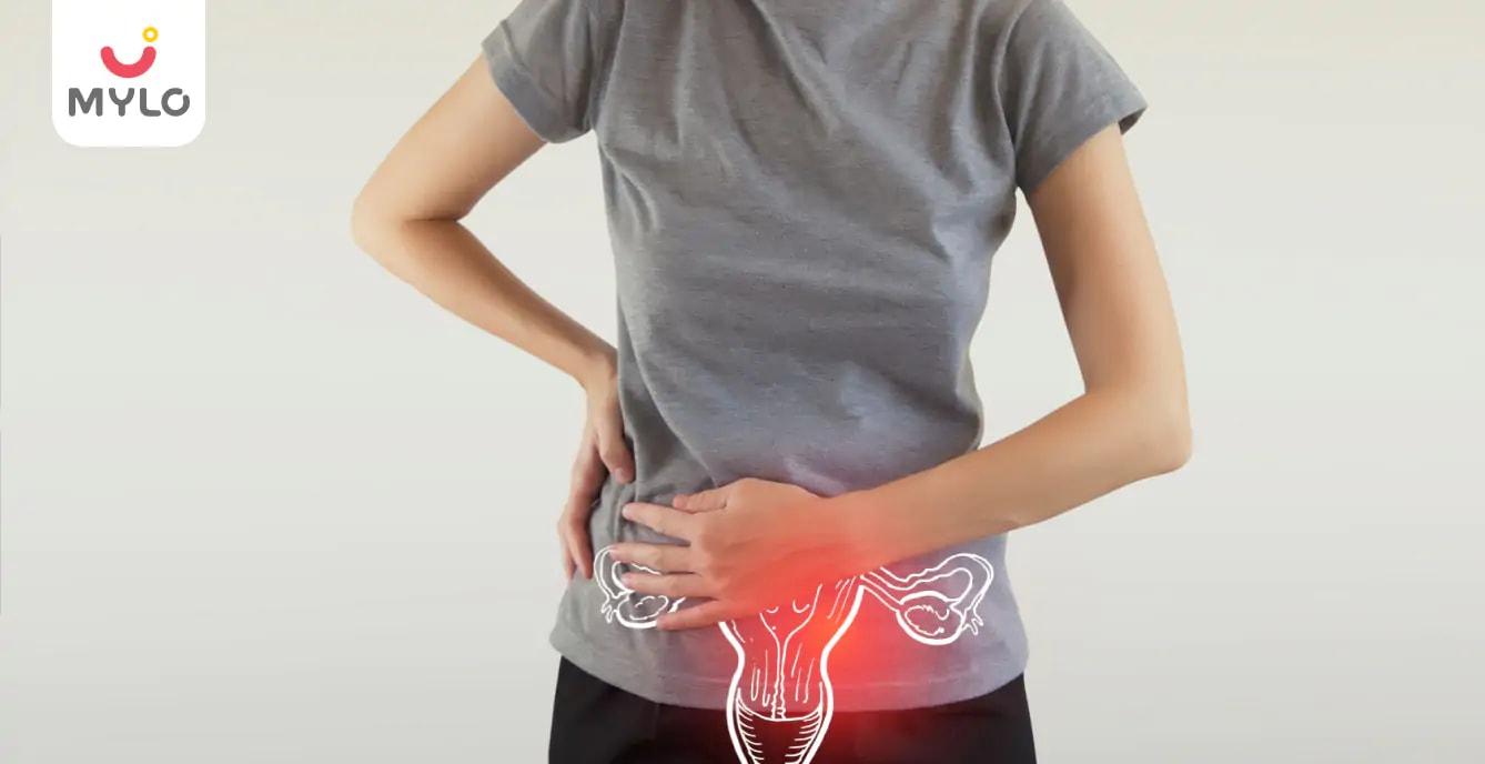 Myomectomy: A Comprehensive Guide to Uterine Fibroid Removal Surgery