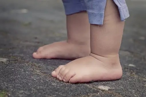 What are the Symptoms of Vitamin D Deficiency in Children?