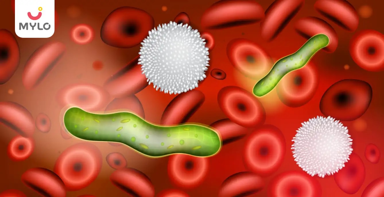 Puerperal Sepsis: Symptoms, Causes, Risks & Treatment