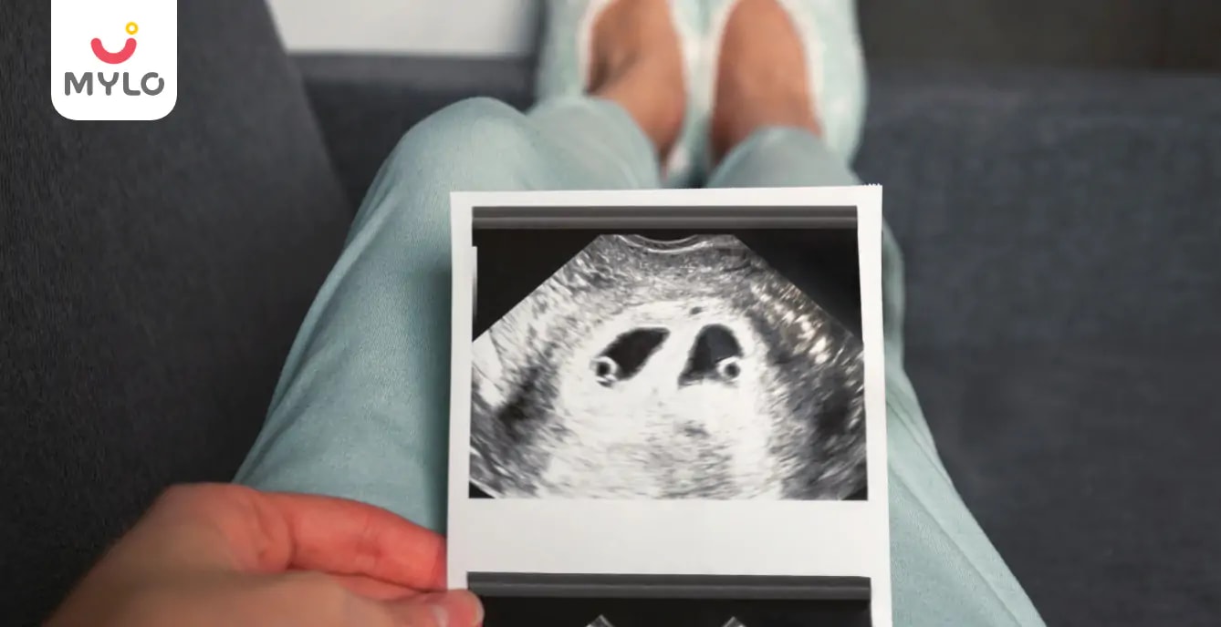 The Ultimate Guide to Twin Pregnancy Symptoms at 4 Weeks