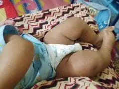 Super Saver Combo - Baby Diaper Pants Medium (M) 7-8 kgs - (76 count) Leak Proof + Extra Virgin Coconut Oil (200ml)