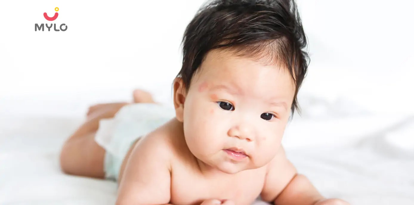 The Ultimate Parent's Guide to Dealing with Boils in Babies
