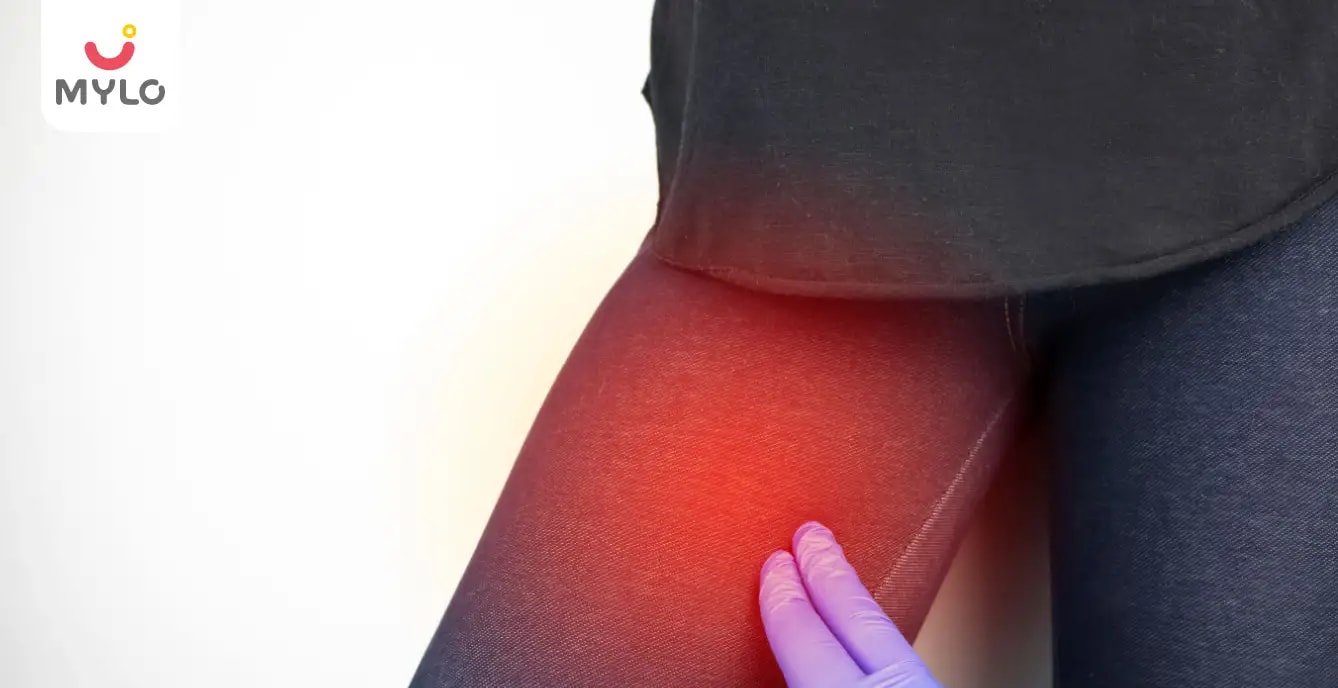 Thigh Chafing: Symptoms, Causes & Presentations