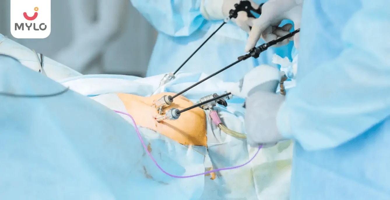Gynecological Laparoscopy in Hindi | गाइनेकोलोजी लैप्रोस्कोपी क्या है और कब पड़ती है इसकी ज़रूरत?
