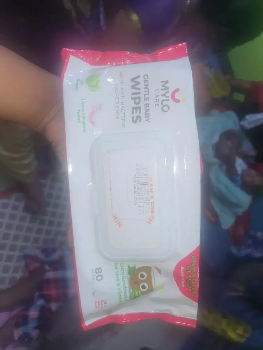 Gentle Baby Wipes With Lid - Organic Coconut Oil, Neem, Aloe Vera and Vitamin E | 98% Pure Water | Dermatologically Tested (Pack of 3) - 72 Wipes Per Pack