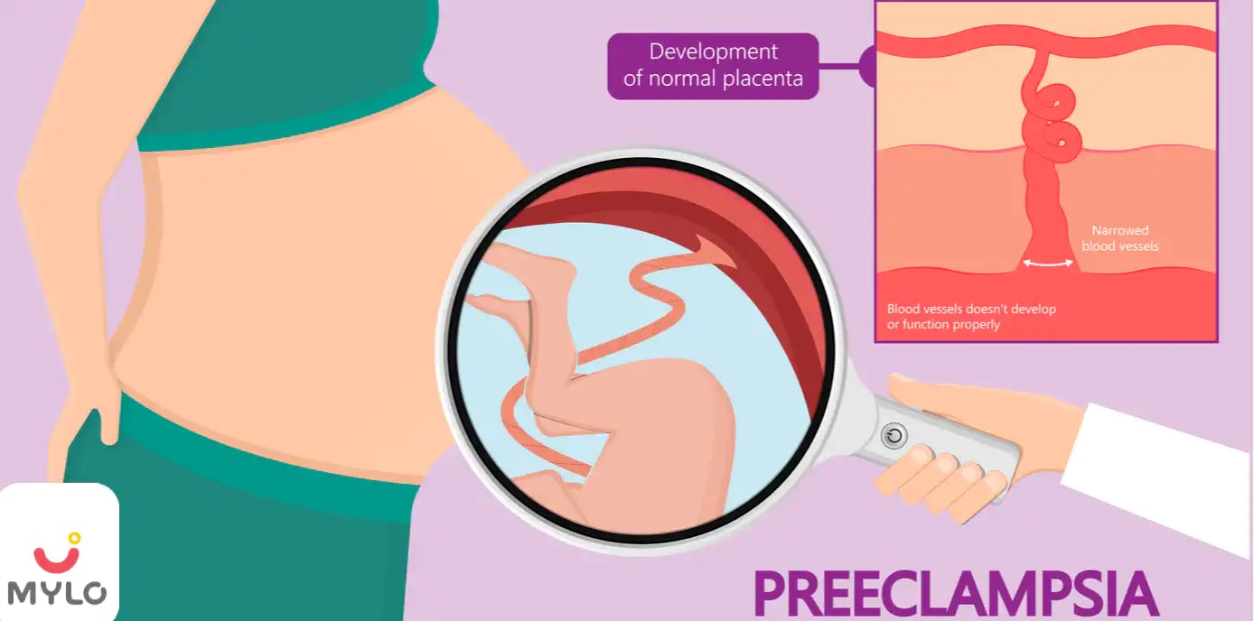 What is a High Risk Pregnancy: Causes, Types, Warning Signs & Management