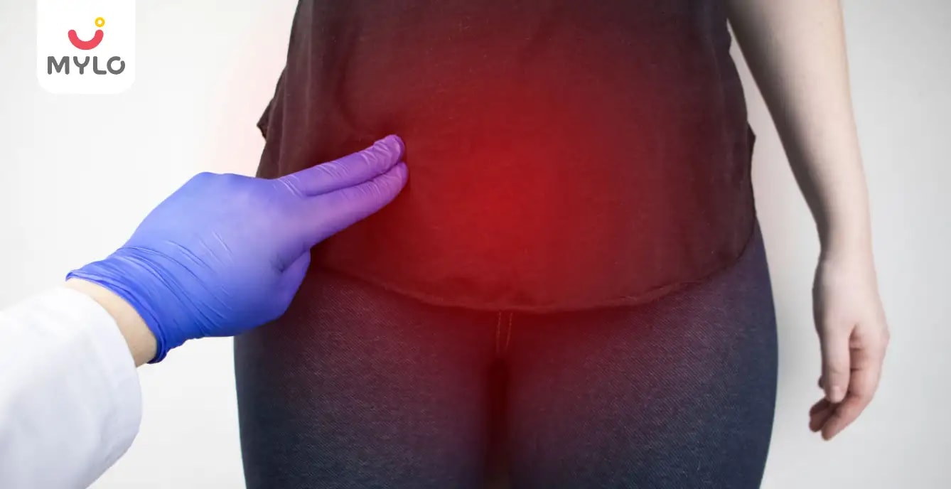Uterine Artery Embolization: A Non-Invasive Solution for Fibroids