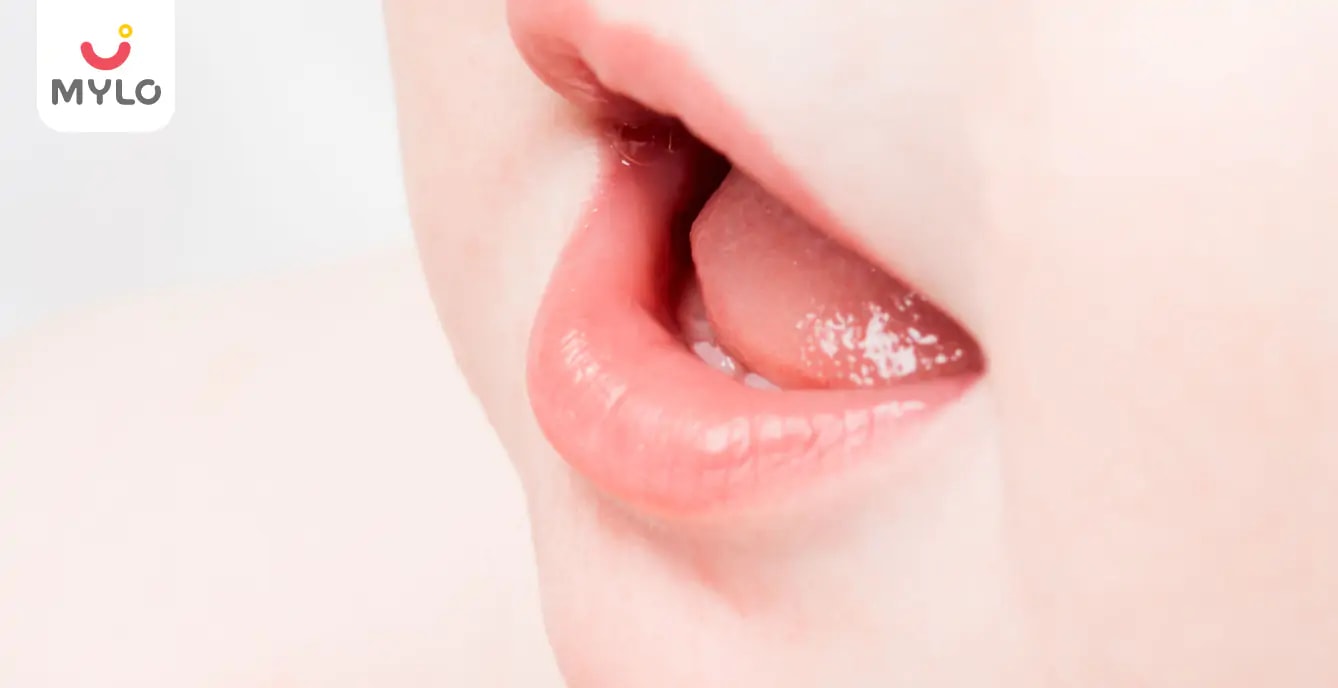 How To Treat Chapped Lips In A Newborn