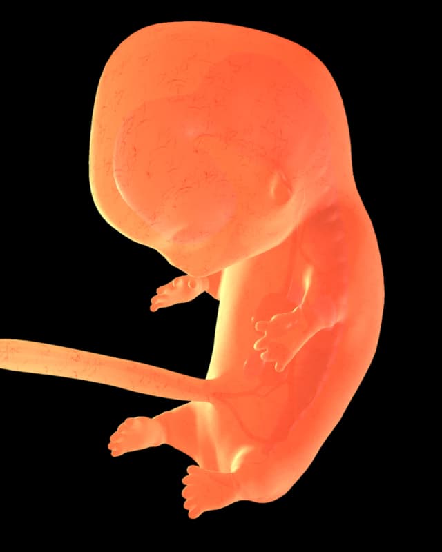 Baby at week 18