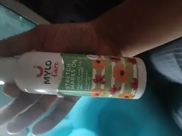 Stretch Marks Oil With Sea Buckthorn, Rosehip, Argan & Coconut Oil | Scars & Stretch Mark Lightening | Natural Skin Care Solution for Pregnant Women - 100ml