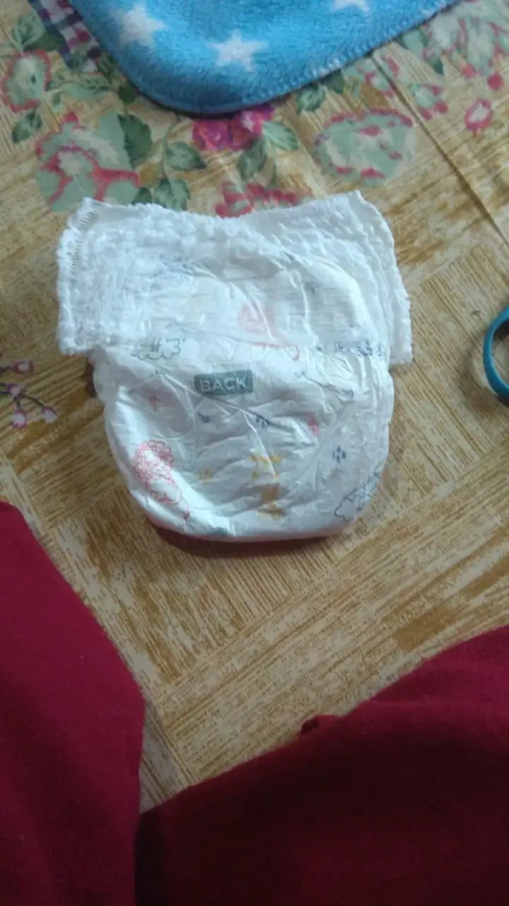 Super Saver Combo - Baby Diaper Pants Medium (M) 7-8 kgs - (76 count) Leak Proof + Extra Virgin Coconut Oil (200ml)