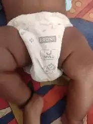 Super Saver Combo - Baby Diaper Pants Medium (M) 7-8 kgs - (76 count) Leak Proof + Extra Virgin Coconut Oil (200ml)