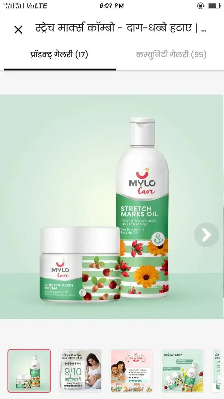 Stretch Marks Kit - Removes Scars | Made with Natural Ingredients | Tightens Skin - (Stretch Mark Oil - 100 ml, Stretch Marks Cream - 100ml)